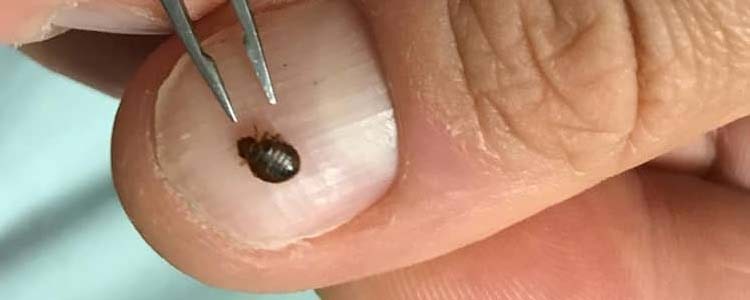 Bed Bug Control Springfield Lakese